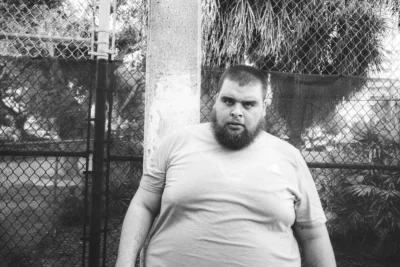 Overweight man standing outdoors, representing the challenge of losing excess weight and the need for effective fat burning strategies like CLA for Weight Loss.